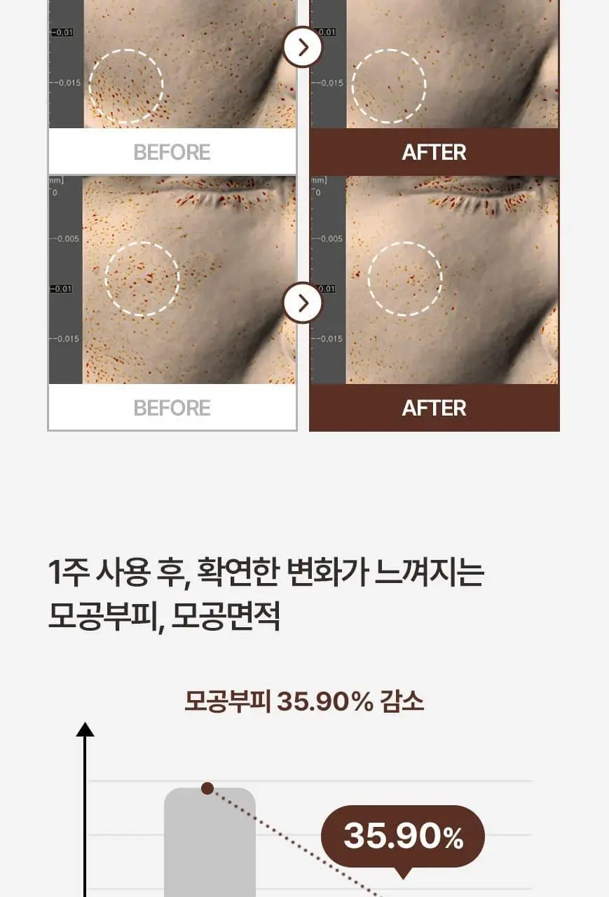 [화해어워드 1위/모공앰플] 닥터오라클 레티노타이트닝 비타민A 레티놀 앰플 50ml 상세페이지 21